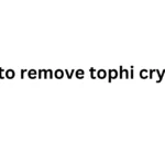 how to remove tophi crystals